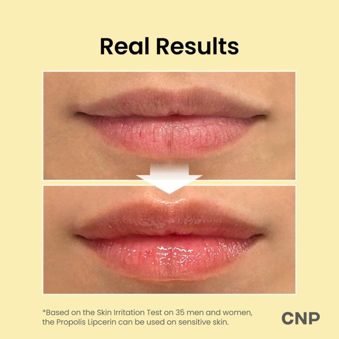 CNP Honey Lip Butter (0.5 fl.oz / 15ml) - Propolis Lipcerin - Image 3